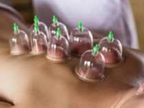 Cupping therapy online course